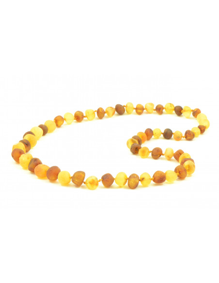 Lemon & Cognac Baroque Raw Amber Beads Necklace for Adult